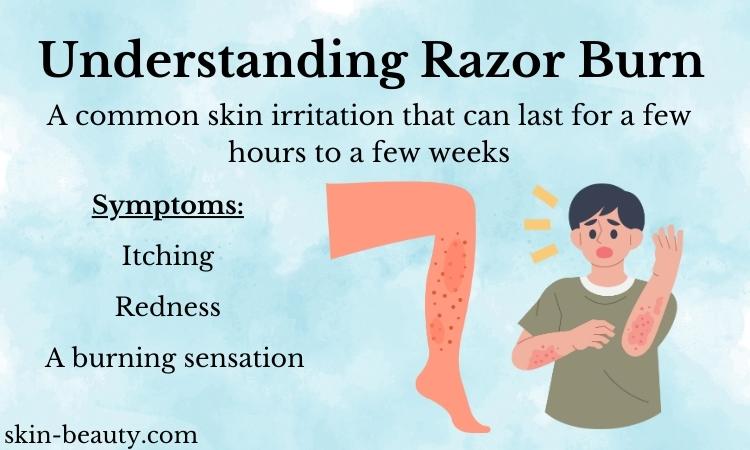 Duration and Treatment: How Long Does Razor Burn Last?