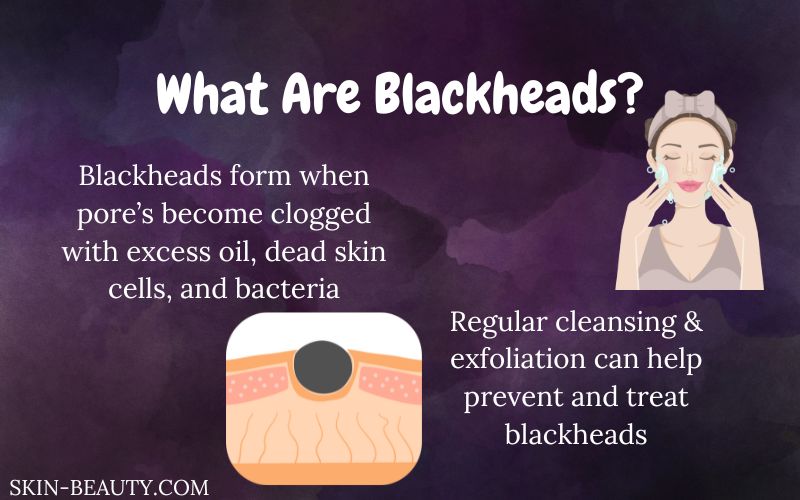 Best Blackhead Removal Treatments: A Guide to Effective Solutions